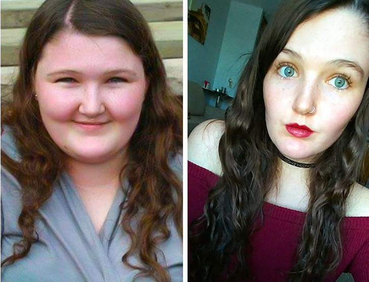 Weight-based Teasing and Bullying : How I Lost 30 Pounds In One Year.