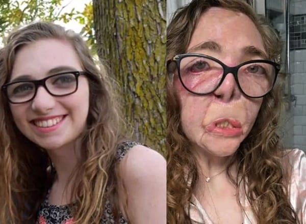 She Went to Walk Two Dogs in Texas. They Nearly Killed Her.