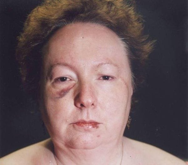 What to Do If Someone Breaks Into Your House: Woman Survives Home Invasion, Kills Intruder in Shocking Act of Self-Defense